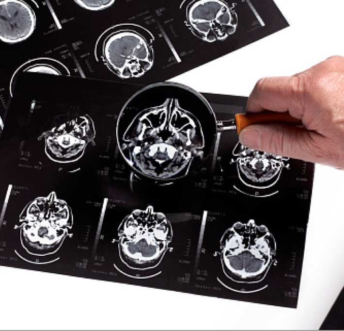 Man's hand using magnifying glass to look at brain scans